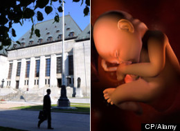 The Supreme Court will decide the case of Ivana Levkovic, who was charged with concealing a dead baby after her building's superintendent found a stillborn child in a garbage bag on her balcony after she moved out. (CP/Alamy)