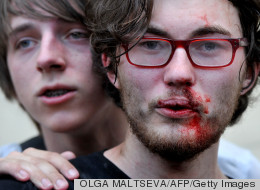 A gay rights activist is seen after clashes with anti-gay demonstrators during a gay pride event in St. Petersburg on June 29, 2013. Russian police arrested dozens of people on Saturday after clashes erupted in the city of Saint Petersburg between pro- and anti-gay demonstrators. (AFP PHOTO / OLGA MALTSEVA)