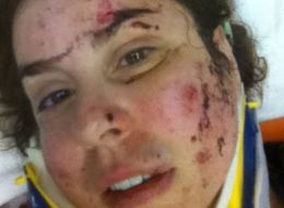 Simona Tibu, a Camrose dentist who says she was assaulted by a sheriff, has been charged.