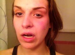 Queen's University student Danielle d'Entremont claims she was attacked by a stranger after receiving threats over her support of feminist activities.