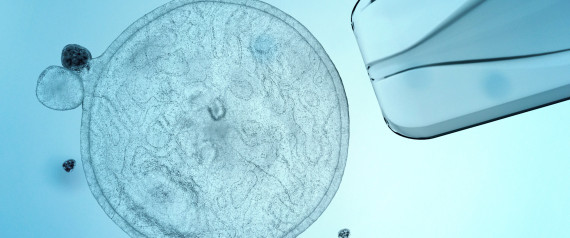 stem cell research cost