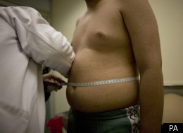 Pierre Dukan Hopes To Combat Child Obesity In France