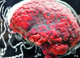 Internet addiction disrupts nerve wiring in the brains of teenagers, a