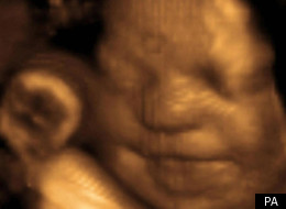 Catholic midwives Doogan and Wood are refusing to supervise staff involved in abortions