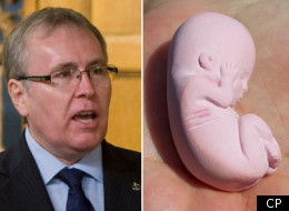 Abortion rights are at the centre of a debate MPs are set to discuss Thursday as they consider whether to hold a special committee to look at when human life begins. Stephen Woodworth, a Conservative MP from Kitchener, Ont., introduced a private members motion calling for the committee. (CP)