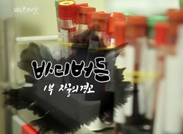 SBS