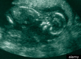 Midwives Mary Doogan and Concepta Wood lost a legal bid challenging a health board's decision they were not entitled to refuse assisting in abortions (file picture)