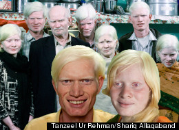 The world's largest family of albinos