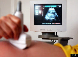 Man Questioned Over Hacking Of Abortion Provider Website Claims Links With Anonymous