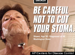 This image provided on Wednesday, March 14, 2012 by the Centers for Disease Control shows Shawn Wright who had a tracheotomy after being diagnosed with head and neck cancer. Tobacco taxes and smoking bans haven't budged the U.S. smoking rate in years. Now the government is trying to shock smokers into quitting with a graphic nationwide advertising campaign. (AP Photo/Centers for Disease Control)