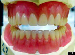 People Should Not Go To Embassies About Missing False Teeth, Insists Hague