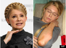 The Ukranian opposition leader before and after her imprisonment