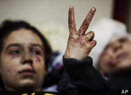In this Saturday, March 10, 2012, file photo, Hana, 12, flashes the victory sign next to her sister Eva, 13, as they recover from severe injuries after the Syrian Army shelled their house in Idlib, north Syria. Their father and two siblings were killed after their home was shelled. (AP Photo/Rodrigo Abd, File)