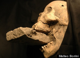 The skull of the
