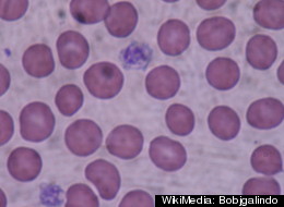 Scientists have developed a synthetic substitute for platelets, which help blood clot.
