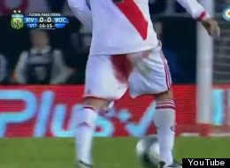 Leo Ponziomidfielder Leo Ponzio continued to play after suffering a ruptured hemorrhoid on Sunday in a match against Boca Unidos.