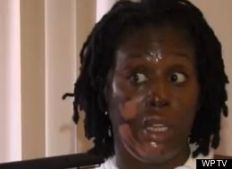 Naomie Breton, 34, suffered second- and third-degree burns after her ex-boyfriend allegedly doused her in gasoline and set her on fire outside of a Florida gas station.