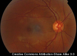 Ophtalmogram of a human eye. The bright circle is the optic disc, and the especially bright inner circle is the optic cup, which researchers have managed to grow in the lab with stem cells.