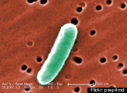 A Calgary lab executive is warning that Alberta could be the next location of an E. coli outbreak. FLICKR: PREP4MD
