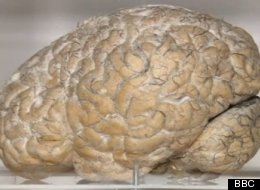 Dr. Mark E. Shelly, a Navy medical examiner has been fined $2,500 by the Virginia Board of Medicine and fired from his part-time job with the state medical examiner's office for taking a Marine's brain out of a specimen jar and letting his children handle the organ