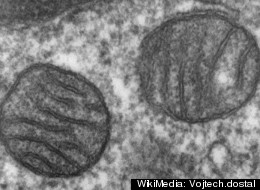 Two mitochondria from a mammalian lung.