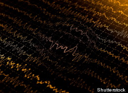 (Shutterstock)