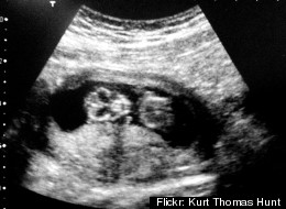 Flickr: Kurt Thomas Hunt