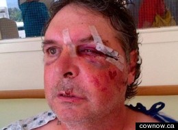 Tom Campen alleges he was beaten by two RCMP officers in Creston B.C. (cownow.ca)