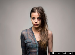 'Half' de Roman Sakovich: Antes y después de las drogas.